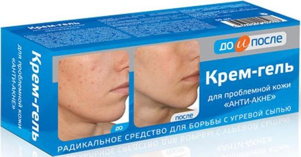 До и после анти-акне крем-гель д/проблемной кожи 50мл
